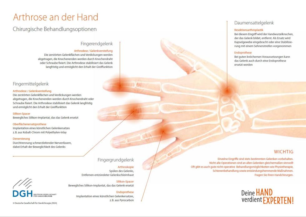 knstliche ngel ohne kleber befestigen Soft Gel  Press on Nails set gnstig kaufen!